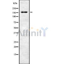 DF8369 at 1/100 staining Human lung tissue by IHC-P. The sample was formaldehyde fixed and a heat mediated antigen retrieval step in citrate buffer was performed. The sample was then blocked and incubated with the antibody for 1.5 hours at 22¡ãC. An HRP conjugated goat anti-rabbit antibody was used as the secondary