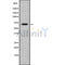 DF8373 staining Hela by IF/ICC. The sample were fixed with PFA and permeabilized in 0.1% Triton X-100,then blocked in 10% serum for 45 minutes at 25¡ãC. The primary antibody was diluted at 1/200 and incubated with the sample for 1 hour at 37¡ãC. An  Alexa Fluor 594 conjugated goat anti-rabbit IgG (H+L) Ab, diluted at 1/600, was used as the secondary antibod