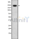 DF8374 staining Hela by IF/ICC. The sample were fixed with PFA and permeabilized in 0.1% Triton X-100,then blocked in 10% serum for 45 minutes at 25¡ãC. The primary antibody was diluted at 1/200 and incubated with the sample for 1 hour at 37¡ãC. An  Alexa Fluor 594 conjugated goat anti-rabbit IgG (H+L) Ab, diluted at 1/600, was used as the secondary antibod