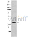 DF8376 at 1/100 staining Human liver tissue by IHC-P. The sample was formaldehyde fixed and a heat mediated antigen retrieval step in citrate buffer was performed. The sample was then blocked and incubated with the antibody for 1.5 hours at 22¡ãC. An HRP conjugated goat anti-rabbit antibody was used as the secondary