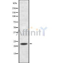 Western blot analysis of extracts from mouse lung, using RANBP1 Antibody. Lane 1 was treated with the antigen-specific peptide.