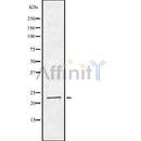 DF8378 at 1/100 staining Human kidney tissue by IHC-P. The sample was formaldehyde fixed and a heat mediated antigen retrieval step in citrate buffer was performed. The sample was then blocked and incubated with the antibody for 1.5 hours at 22¡ãC. An HRP conjugated goat anti-rabbit antibody was used as the secondary