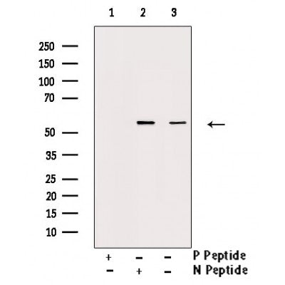 AF3005 staining HeLa by IF/ICC. The sample were fixed with PFA and permeabilized in 0.1% Triton X-100,then blocked in 10% serum for 45 minutes at 25¡ãC. The primary antibody was diluted at 1/200 and incubated with the sample for 1 hour at 37¡ãC. An  Alexa Fluor 594 conjugated goat anti-rabbit IgG (H+L) Ab, diluted at 1/600, was used as the secondary antibod