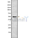 Western blot analysis of CD209 using Jurkat whole cell lysates