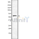 DF8387 staining Hela by IF/ICC. The sample were fixed with PFA and permeabilized in 0.1% Triton X-100,then blocked in 10% serum for 45 minutes at 25¡ãC. The primary antibody was diluted at 1/200 and incubated with the sample for 1 hour at 37¡ãC. An  Alexa Fluor 594 conjugated goat anti-rabbit IgG (H+L) Ab, diluted at 1/600, was used as the secondary antibod