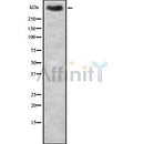 DF8390 staining SW480 cells by ICC/IF. The sample were fixed with PFA and permeabilized in 0.1% Triton X-100,then blocked in 10% serum for 45 minutes at 25¡ãC. The primary antibody was diluted at 1/200 and incubated with the sample for 1 hour at 37¡ãC. An  Alexa Fluor 594 conjugated goat anti-rabbit IgG (H+L) antibody(Cat.