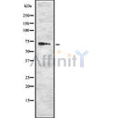 Western blot analysis of RYK using K562 whole cell lysates