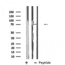 Western blot analysis of ABCG5 using NIH-3T3 whole cell lysates