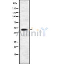 Western blot analysis of TPBG using NIH-3T3 whole cell lysates