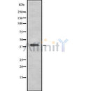 Western blot analysis of TMEFF2 using RAW264.7 whole cell lysates