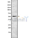 Western blot analysis of METAP2 using NIH-3T3 whole cell lysates
