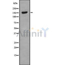 Western blot analysis NUP98 using MCF7 whole cell lysates