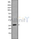 Western blot analysis SRD5A2 using HepG2 whole cell lysates