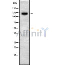 DF8425 staining HepG2 by IF/ICC. The sample were fixed with PFA and permeabilized in 0.1% Triton X-100,then blocked in 10% serum for 45 minutes at 25¡ãC. The primary antibody was diluted at 1/200 and incubated with the sample for 1 hour at 37¡ãC. An  Alexa Fluor 594 conjugated goat anti-rabbit IgG (H+L) Ab, diluted at 1/600, was used as the secondary antibod