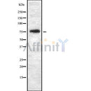 Western blot analysis of THOC5 using HepG2 whole cell lysates