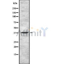 Western blot analysis GNRHR using HuvEc whole cell lysates