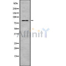 DF8430 staining 293T by IF/ICC. The sample were fixed with PFA and permeabilized in 0.1% Triton X-100,then blocked in 10% serum for 45 minutes at 25¡ãC. The primary antibody was diluted at 1/200 and incubated with the sample for 1 hour at 37¡ãC. An  Alexa Fluor 594 conjugated goat anti-rabbit IgG (H+L) Ab, diluted at 1/600, was used as the secondary antibod