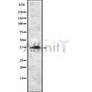 DF8437 at 1/100 staining Human lung tissue by IHC-P. The sample was formaldehyde fixed and a heat mediated antigen retrieval step in citrate buffer was performed. The sample was then blocked and incubated with the antibody for 1.5 hours at 22¡ãC. An HRP conjugated goat anti-rabbit antibody was used as the secondary