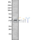 DF8442 at 1/100 staining Human gastric tissue by IHC-P. The sample was formaldehyde fixed and a heat mediated antigen retrieval step in citrate buffer was performed. The sample was then blocked and incubated with the antibody for 1.5 hours at 22¡ãC. An HRP conjugated goat anti-rabbit antibody was used as the secondary