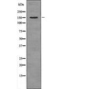 Western blot analysis NPC1L1 using COLO205 whole cell lysates