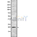 Western blot analysis of ARF5 using K562 whole cell lysates