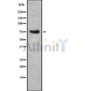 Western blot analysis of THOC1 using COLO205 whole cell lysates