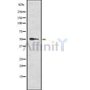 Western blot analysis of RXRA using Jurkat whole cell lysates