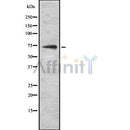 DF8465 at 1/100 staining Human lymph node tissue by IHC-P. The sample was formaldehyde fixed and a heat mediated antigen retrieval step in citrate buffer was performed. The sample was then blocked and incubated with the antibody for 1.5 hours at 22¡ãC. An HRP conjugated goat anti-rabbit antibody was used as the secondary