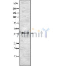Western blot analysis of ETV2 using K562 whole cell lysates