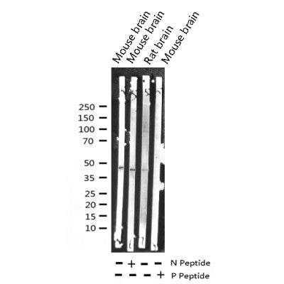 AF3011 staining 293 by IF/ICC. The sample were fixed with PFA and permeabilized in 0.1% Triton X-100,then blocked in 10% serum for 45 minutes at 25¡ãC. The primary antibody was diluted at 1/200 and incubated with the sample for 1 hour at 37¡ãC. An  Alexa Fluor 594 conjugated goat anti-rabbit IgG (H+L) Ab, diluted at 1/600, was used as the secondary antibod