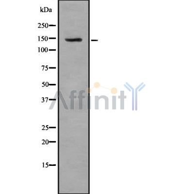 Western blot analysis of TAT using K562 whole cell lysates