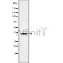 Western blot analysis SIRT4 using Jurkat whole cell lysates