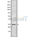 DF8504 at 1/100 staining Human gastric tissue by IHC-P. The sample was formaldehyde fixed and a heat mediated antigen retrieval step in citrate buffer was performed. The sample was then blocked and incubated with the antibody for 1.5 hours at 22¡ãC. An HRP conjugated goat anti-rabbit antibody was used as the secondary