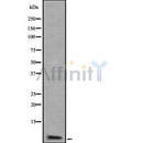 Western blot analysis of ATP5J2 using K562 whole cell lysates