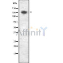 DF8506 at 1/100 staining Mouse colon tissue by IHC-P. The sample was formaldehyde fixed and a heat mediated antigen retrieval step in citrate buffer was performed. The sample was then blocked and incubated with the antibody for 1.5 hours at 22¡ãC. An HRP conjugated goat anti-rabbit antibody was used as the secondary