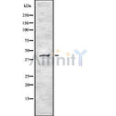 DF8507 at 1/100 staining Human pancreas tissue by IHC-P. The sample was formaldehyde fixed and a heat mediated antigen retrieval step in citrate buffer was performed. The sample was then blocked and incubated with the antibody for 1.5 hours at 22¡ãC. An HRP conjugated goat anti-rabbit antibody was used as the secondary