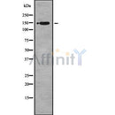 Western blot analysis of BRCAA1 using HuvEc whole cell lysates
