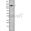 Western blot analysis of Brm using HuvEc whole cell lysates
