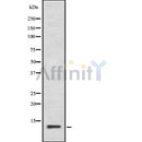 DF8512 at 1/100 staining Human pancreas tissue by IHC-P. The sample was formaldehyde fixed and a heat mediated antigen retrieval step in citrate buffer was performed. The sample was then blocked and incubated with the antibody for 1.5 hours at 22¡ãC. An HRP conjugated goat anti-rabbit antibody was used as the secondary