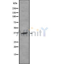DF8514 at 1/100 staining Human kidney tissue by IHC-P. The sample was formaldehyde fixed and a heat mediated antigen retrieval step in citrate buffer was performed. The sample was then blocked and incubated with the antibody for 1.5 hours at 22¡ãC. An HRP conjugated goat anti-rabbit antibody was used as the secondary
