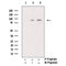 AF3013 staining HepG2 by IF/ICC. The sample were fixed with PFA and permeabilized in 0.1% Triton X-100,then blocked in 10% serum for 45 minutes at 25¡ãC. The primary antibody was diluted at 1/200 and incubated with the sample for 1 hour at 37¡ãC. An  Alexa Fluor 594 conjugated goat anti-rabbit IgG (H+L) Ab, diluted at 1/600, was used as the secondary antibod