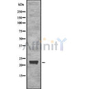 Western blot analysis of CD179b using LOVO whole cell lysates