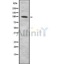 Western blot analysis of CD203c using 293 whole cell lysates