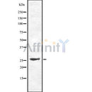 Western blot analysis of Cdc34 using HepG2 whole cell lysates