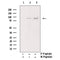 AF3014 staining HepG2 by IF/ICC. The sample were fixed with PFA and permeabilized in 0.1% Triton X-100,then blocked in 10% serum for 45 minutes at 25¡ãC. The primary antibody was diluted at 1/200 and incubated with the sample for 1 hour at 37¡ãC. An  Alexa Fluor 594 conjugated goat anti-rabbit IgG (H+L) Ab, diluted at 1/600, was used as the secondary antibod