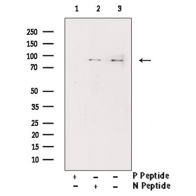 AF3014 staining HepG2 by IF/ICC. The sample were fixed with PFA and permeabilized in 0.1% Triton X-100,then blocked in 10% serum for 45 minutes at 25¡ãC. The primary antibody was diluted at 1/200 and incubated with the sample for 1 hour at 37¡ãC. An  Alexa Fluor 594 conjugated goat anti-rabbit IgG (H+L) Ab, diluted at 1/600, was used as the secondary antibod