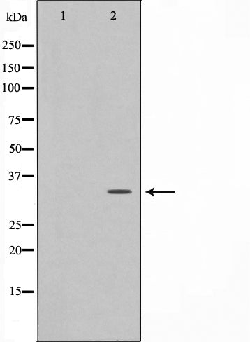 Western blot analysis on HuvEc cell lysate using C/EBP-epsilon Antibody.The lane on the left is treated with the antigen-specific peptide.