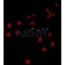 AF0085 staining HuvEc by IF/ICC. The sample were fixed with PFA and permeabilized in 0.1% Triton X-100,then blocked in 10% serum for 45 minutes at 25¡ãC. The primary antibody was diluted at 1/200 and incubated with the sample for 1 hour at 37¡ãC. An  Alexa Fluor 594 conjugated goat anti-rabbit IgG (H+L) Ab, diluted at 1/600, was used as the secondary antibod
