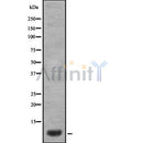 DF8528 at 1/100 staining Mouse kidney tissue by IHC-P. The sample was formaldehyde fixed and a heat mediated antigen retrieval step in citrate buffer was performed. The sample was then blocked and incubated with the antibody for 1.5 hours at 22¡ãC. An HRP conjugated goat anti-rabbit antibody was used as the secondary