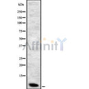 Western blot analysis of Defensin ?1 using Jurkat whole cell lysates